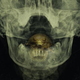 Illustration for article titled The Bay Is A Grotesque, Giant Tongue-Eating Parasite Tease